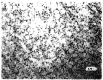 10-7 Microstructure of a cobalt-chromium-molybdenum alloy manufactured by rapid omnidirectional pressing.png