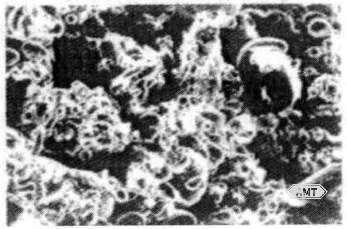 10-13 SEM micrograph (250×) of atomized dental amalgam powder.png